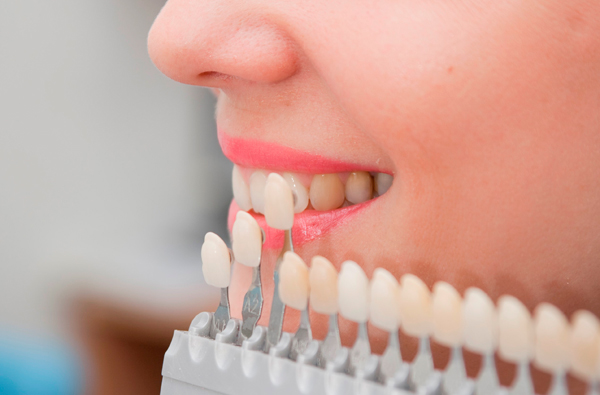 Implantes dentales económicos